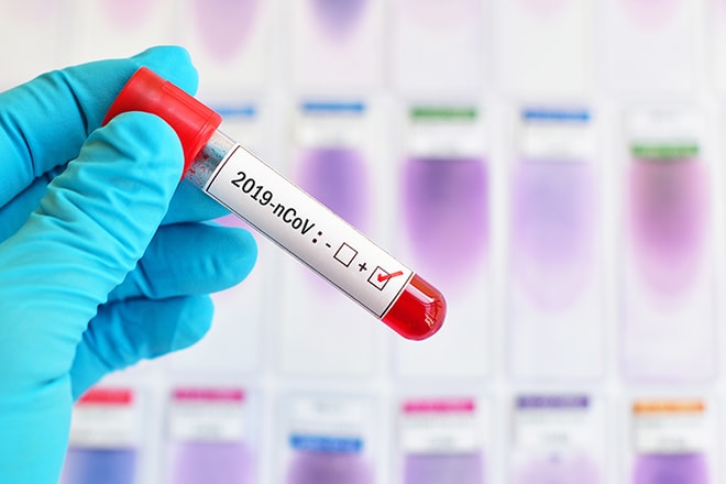 Blood Sample Tube Positive With 2019 Ncov, Novel Coronavirus 201