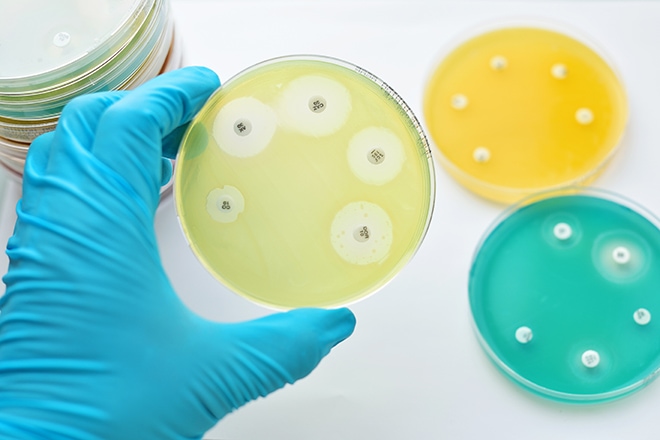 Antimicrobial Susceptibility Testing